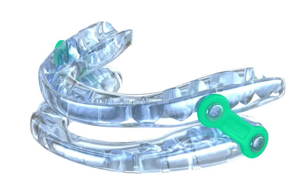 Benefits of Custom Dental Oral Appliances for Sleep Apnea
