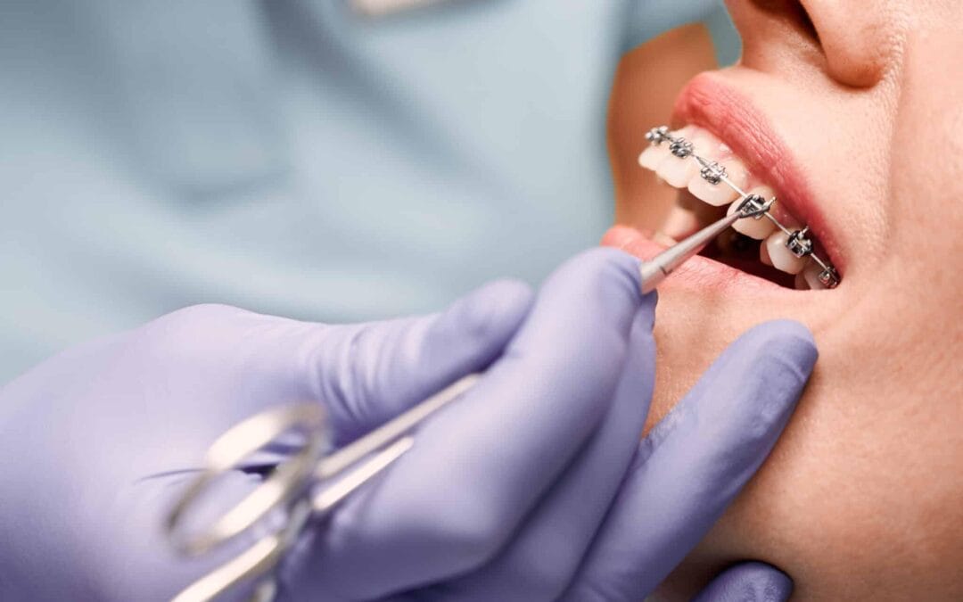 How Early Orthodontics Can Prevent Bigger Problems Later