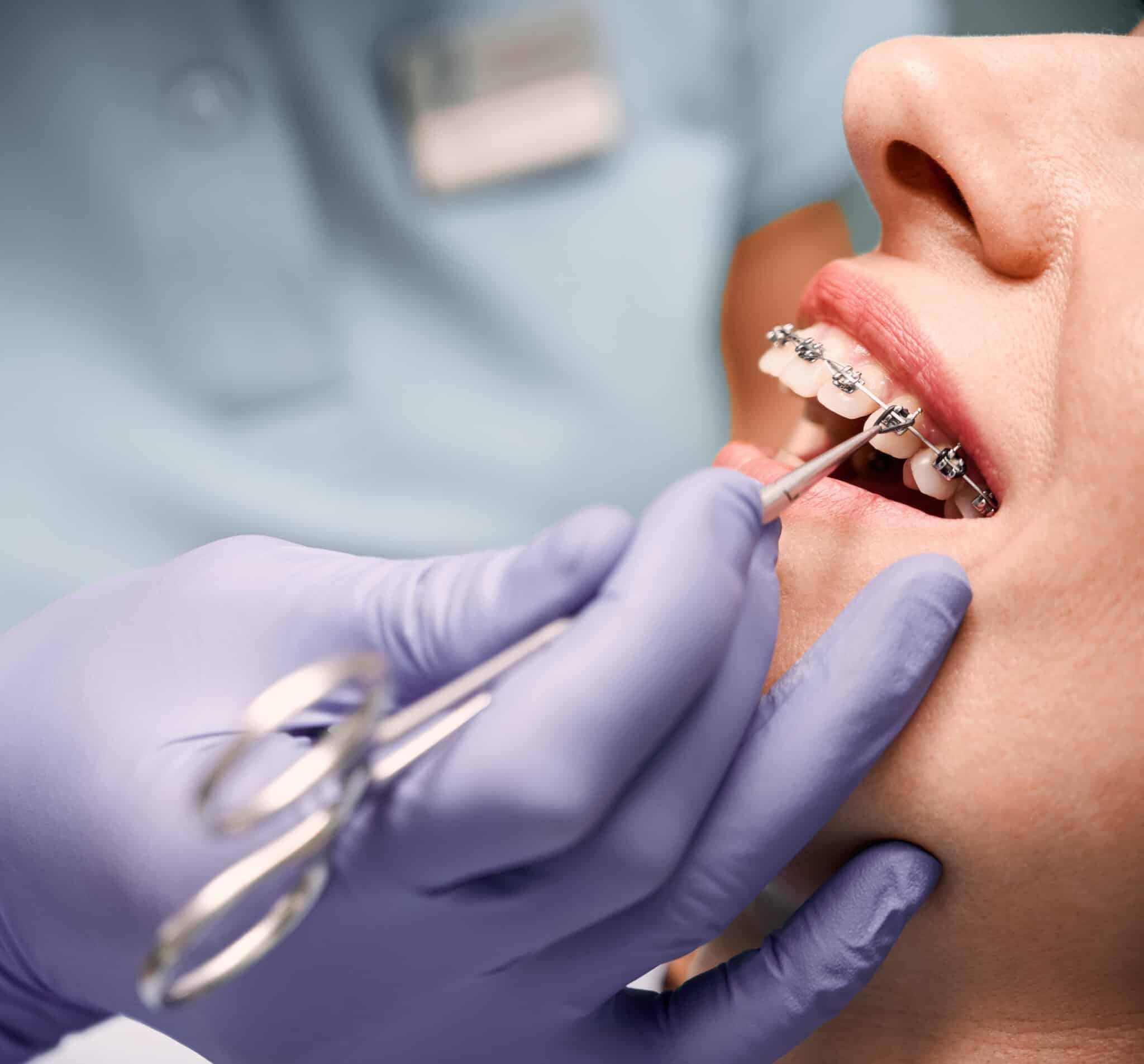 orthodontic treatment dental implants richmond