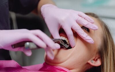 Guiding Your Child’s Smile: Why Early Intervention Orthodontics Can Prevent Complex Extractions Later